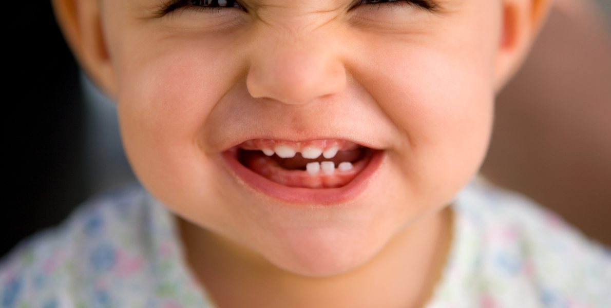 Why Waiting for All Baby Teeth to Fall Out Is a Myth in Orthodontics?