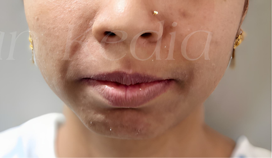 Clear Aligners Andheri