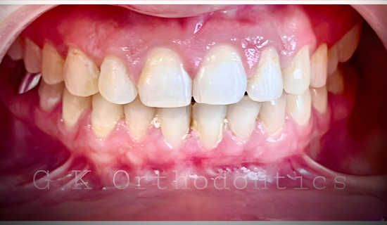 Braces specialist Andheri