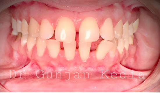 Braces specialist Chanivali