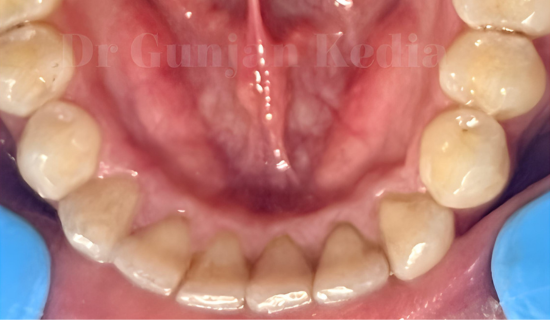 Orthodontist Chandivali