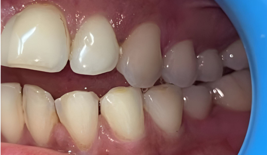 Best Dentist for Braces in Powai