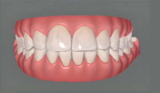 Best Dentist for Braces in Powai