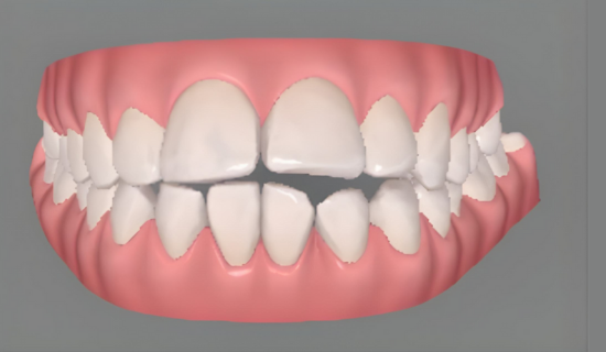 Best Dentist for Braces in Powai