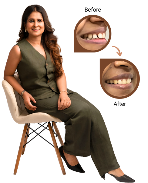 Dr. Gunjan Kedia - Braces>