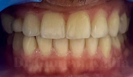 Braces specialist Andheri