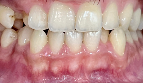 Braces specialist Powai