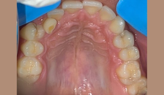 Orthodontist Powai