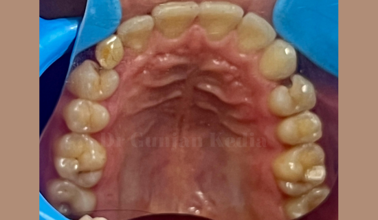Orthodontist Hiranandani, Powai