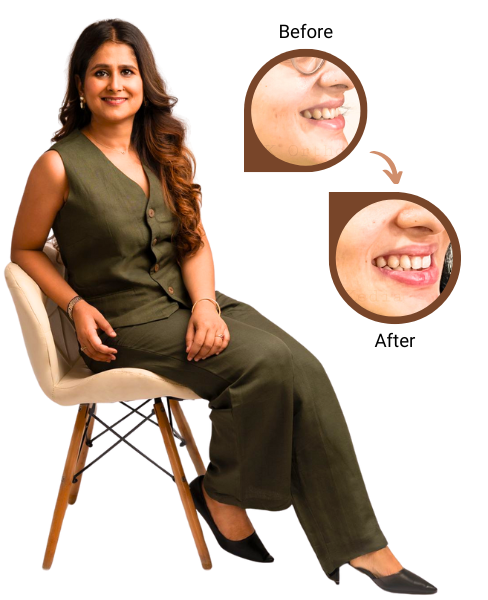 Dr. Gunjan Kedia - Braces>