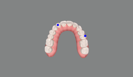 Children's Dentist Near Hiranandani, Powai
