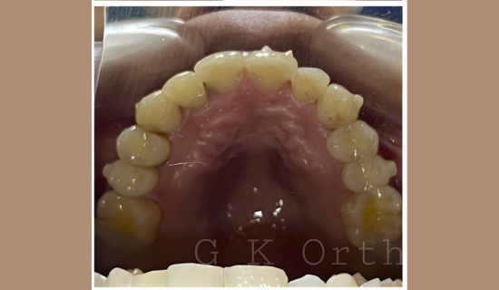 Children's Dentist Near Hiranandani, Powai