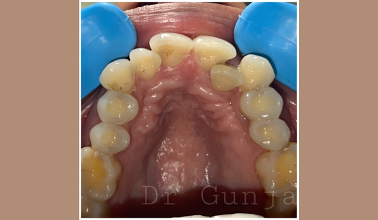 Children's Dentist Near Hiranandani, Powai