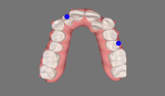 Children's Dentist Near Hiranandani, Powai