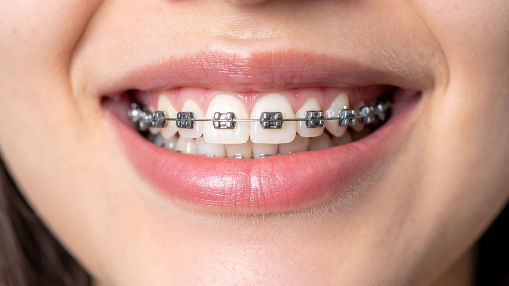Braces specialist Powai
