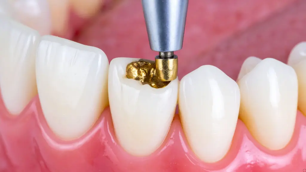 Cosmetic tooth filling specialist Powai