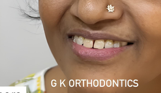 Invisalign for Adults