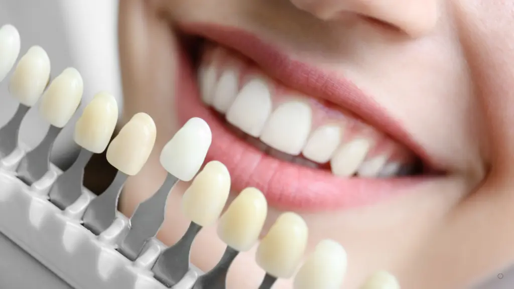 Teeth Whitening specialist Powai