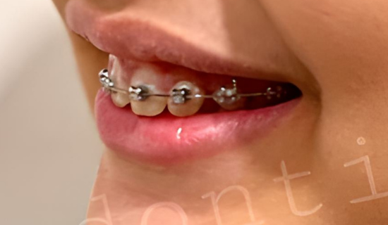 Children's Dentist Near Hiranandani, Powai