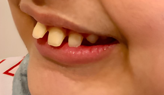 Children's Dentist Near Hiranandani, Powai