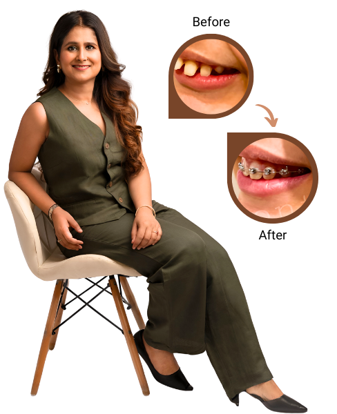 Dr. Gunjan Kedia - Braces>